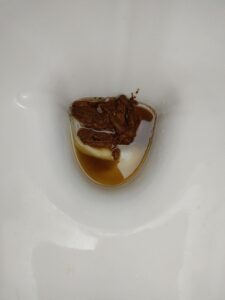 Photo de 💩🚽👍