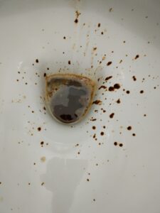 Photo de 🚽🤢😕