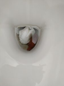 Photo de Caca qui fait suite à une constipation