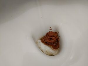 Photo de caca