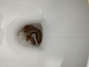 Photo de 💩
