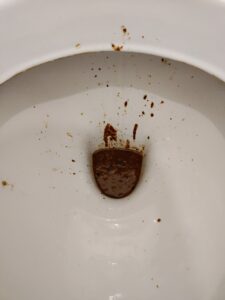Photo de diarrhée