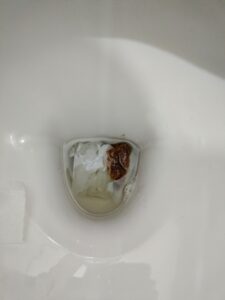Photo de caca