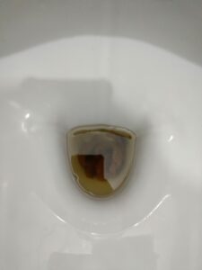 Photo de cacas