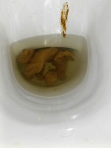 Photo de Ça pue
