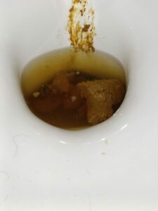 Photo de Grosse décharge