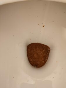 Photo de Diarrhée