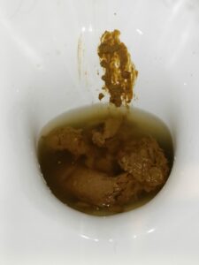 Photo de Caca après 2 jours sans chier