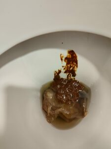 Photo de caca