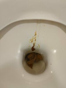 Photo de décharge de merde