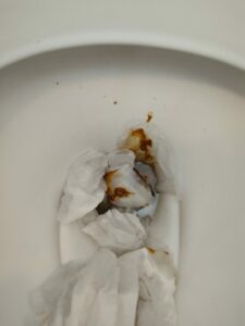Photo de merde