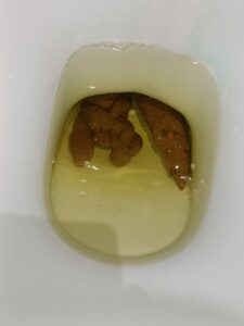 Photo de 3 grosses crottes au fond du chiotte