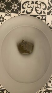 Photo de caca diarrhée pas diarrhée
