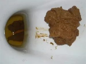Photo de mate  ma diaré aigue