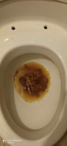 Photo de La Caca despedazada