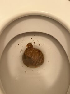 Photo de Brown supernova