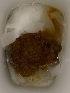 Photo de Diarrhoea Disease