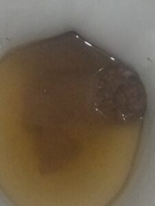 Photo de baby poop