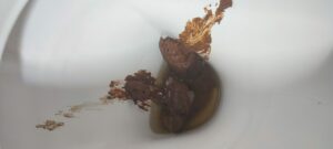 Photo de Sushi poop After 5 days
