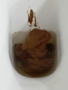 Photo de Stone poop