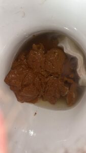 Photo de Aprés curry