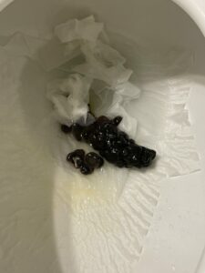 Photo de Lumps of dark poo