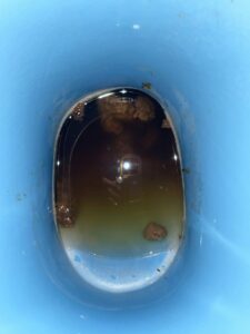 Photo de Diarrhea